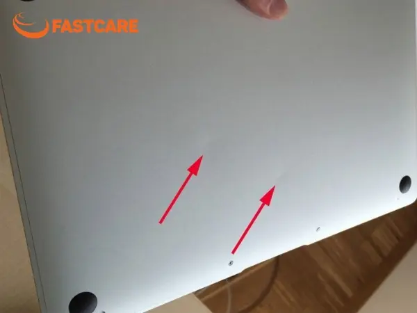 MacBook bị móp