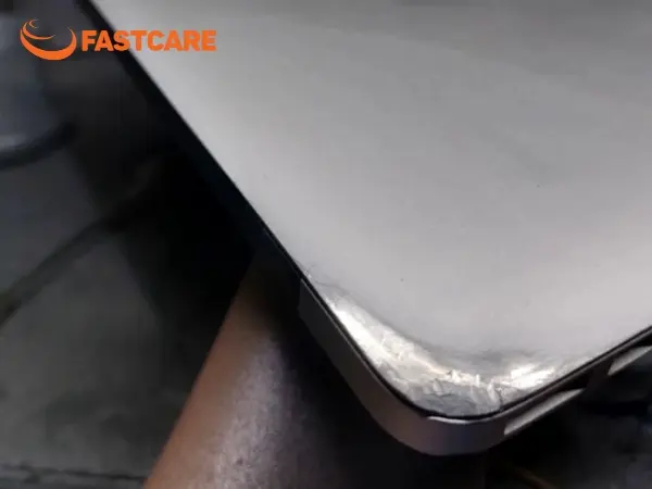 MacBook bị móp