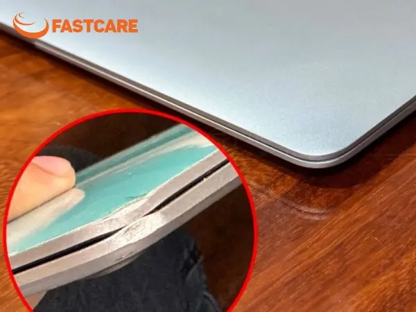 MacBook bị móp