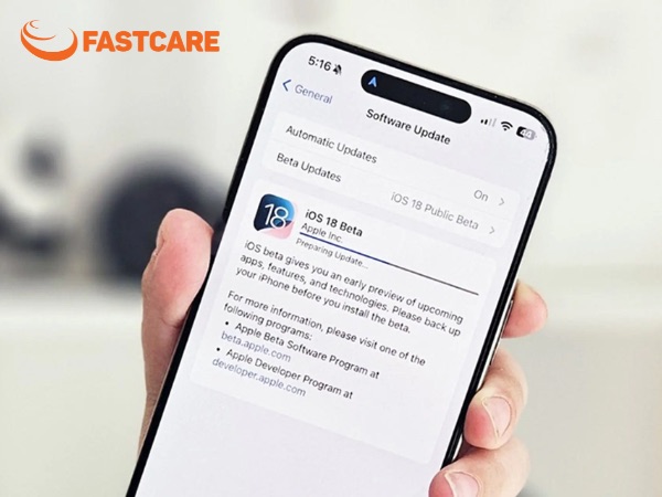 màn hình iphone bị lưu ảnh