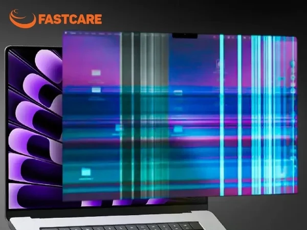 màn hình macbook bị nhiễu